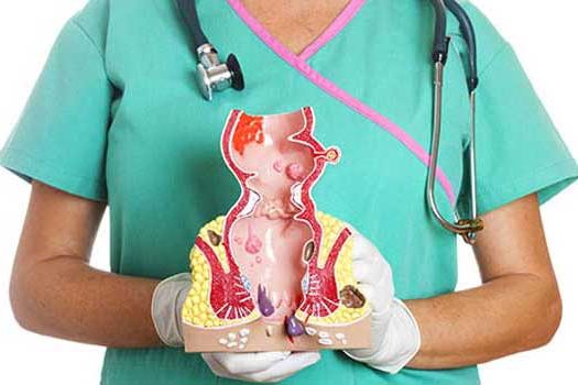 Laser: Πόνος τέλος στη θεραπεία των «αιμορροϊδών»