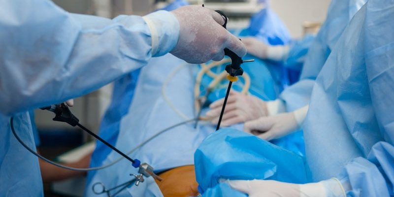 Ενδοσκοπική επανάσταση στη θεραπεία της βουβωνοκήλης Ενδοσκοπική επανάσταση στη θεραπεία της βουβωνοκήλης